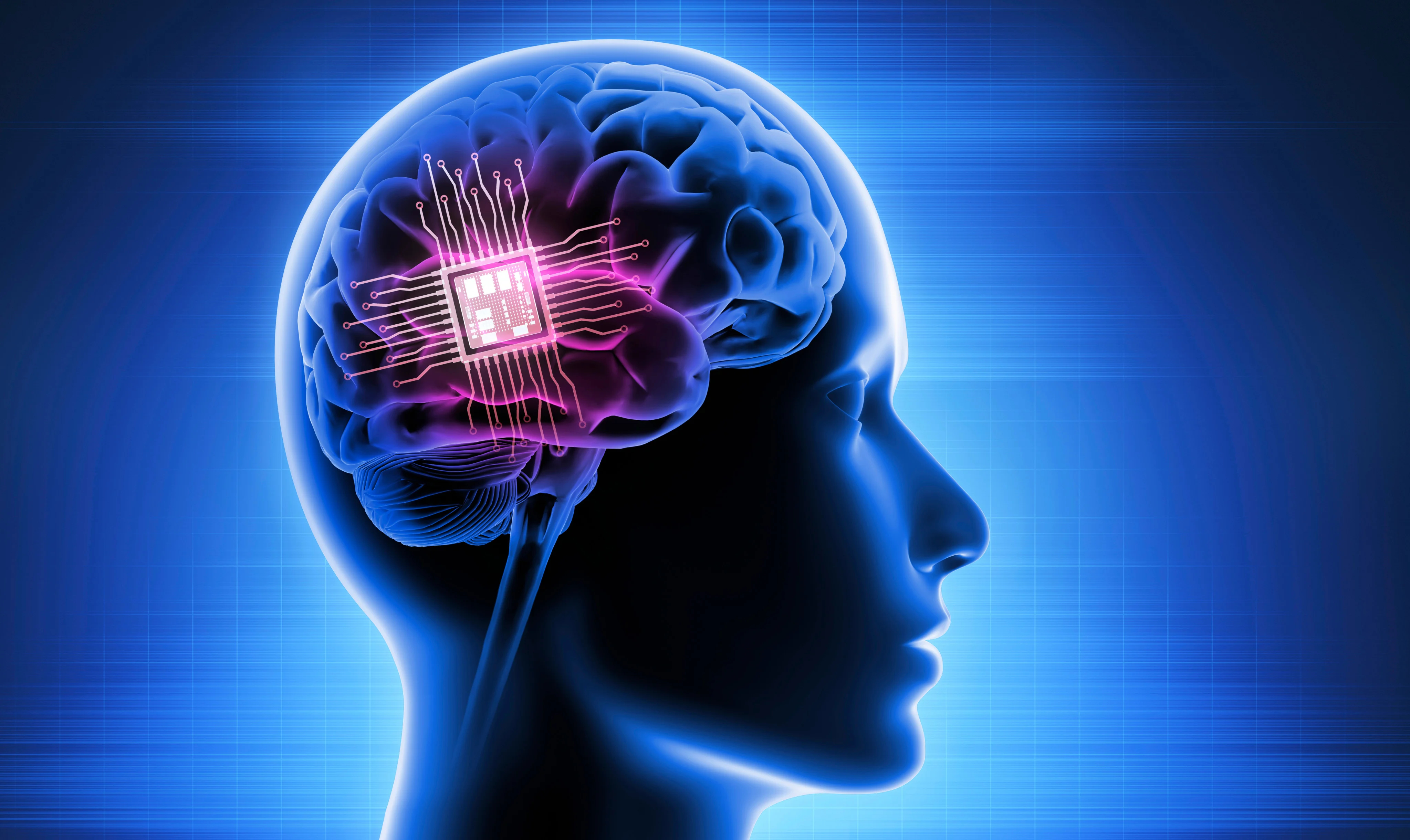 The World's First Brain Computer Interface Device Approved Beyond Clinical Trials